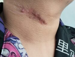 Riwayat Gangguan Jiwa AS Disorot, Pengacara Desak Pembantaran untuk Kontrol Medis